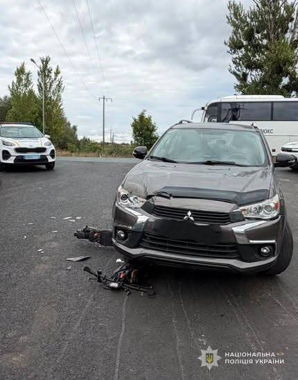Траса Львів–Рава-Руська: авто збило 13-річну дівчинку на електросамокаті